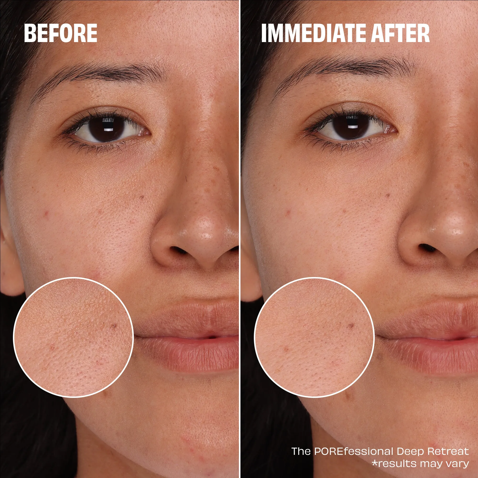 Benefit All You Knead Is Pore Care Set