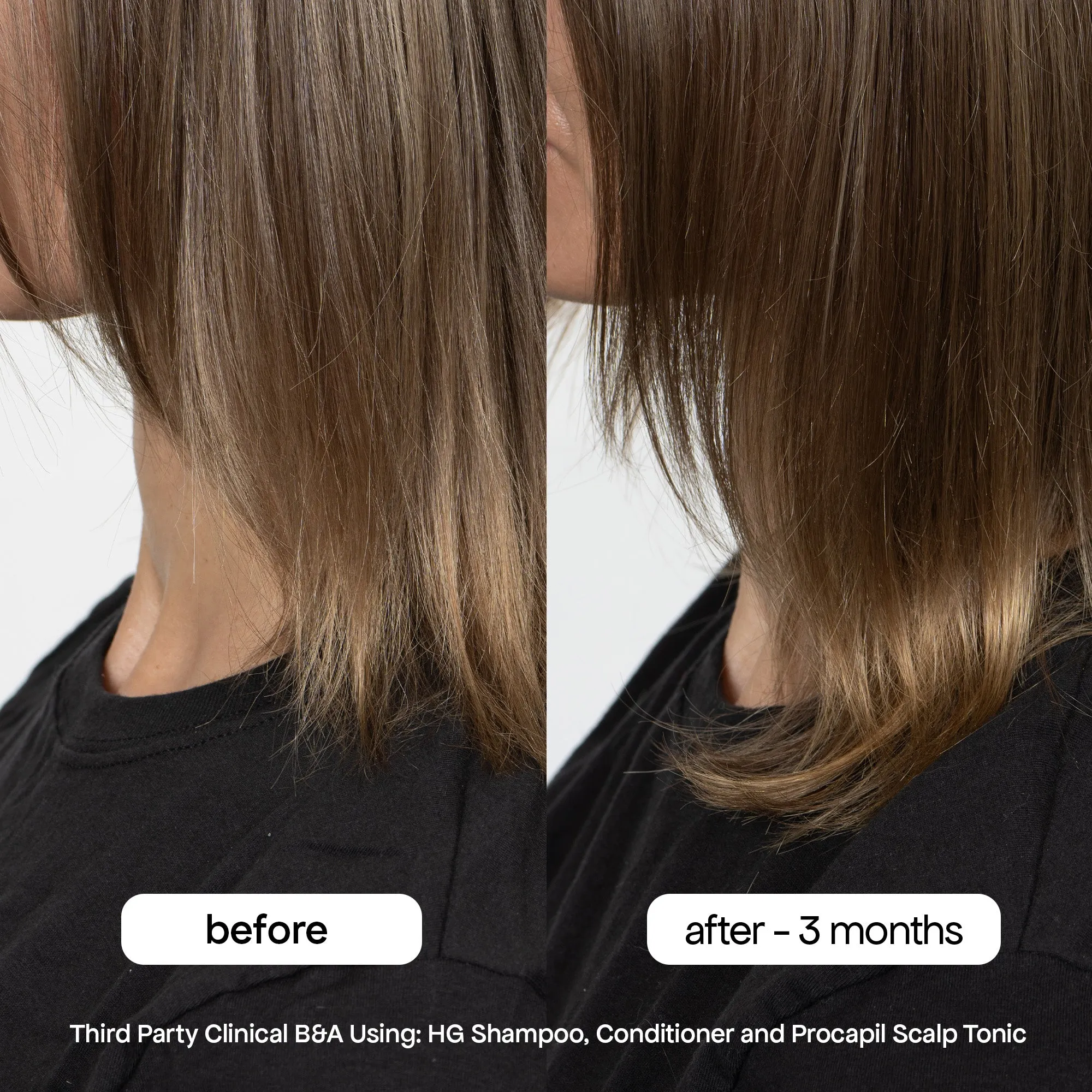 MINI ANTI-THINNING PROCAPIL® SCALP TONIC